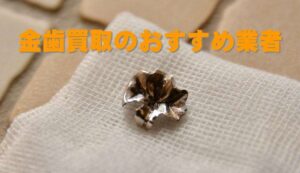 金歯買取のおすすめ業者